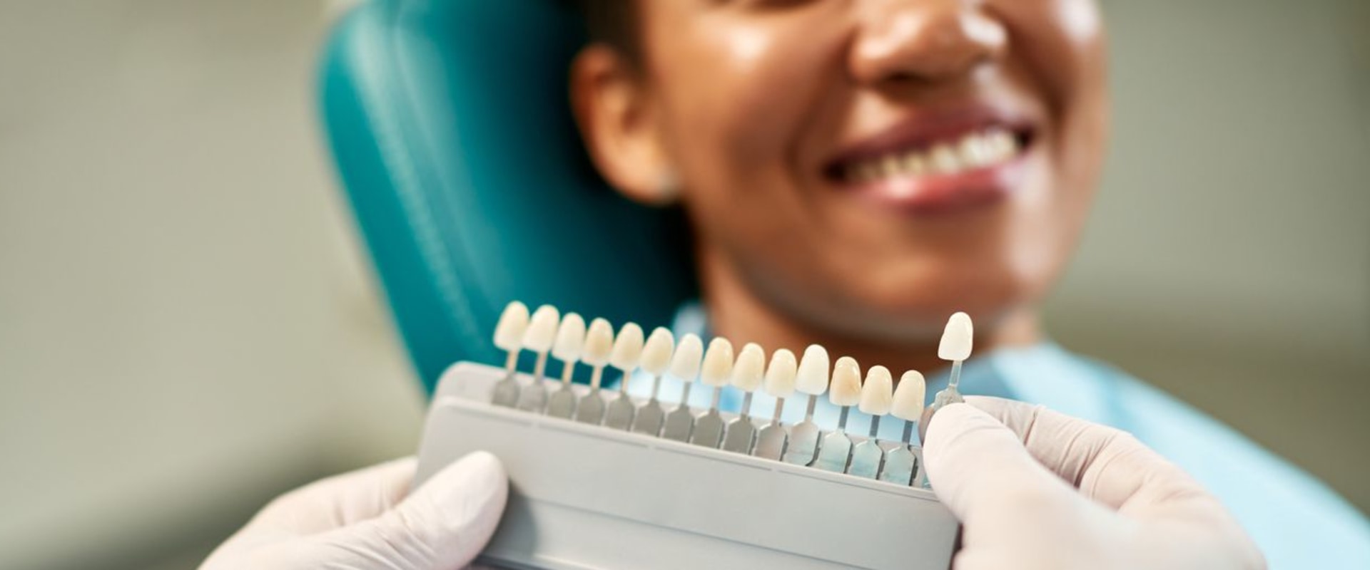 How often do veneers need to be replaced?