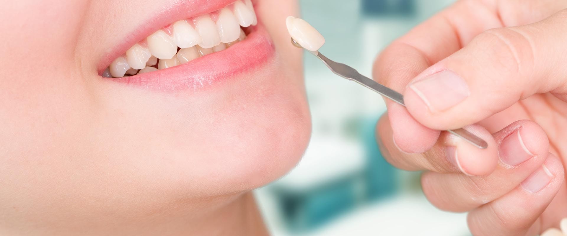 Can porcelain veneers last a lifetime?